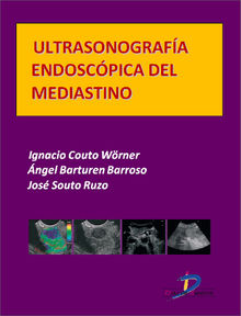 Ultrasonografa endoscpica del mediastino