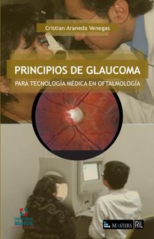 Principios de glaucoma para tecnologa medica en oftalmologa