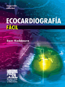 Ecocardiografa fcil