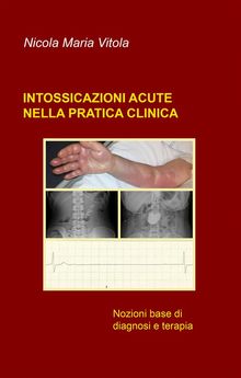 Intossicazioni acute nella pratica clinica