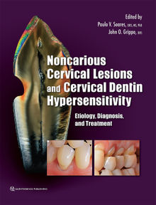 Noncarious Cervical Lesions and Cervical Dentin Hypersensitivity 