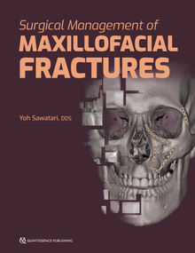 Surgical Management of Maxillofacial Fractures