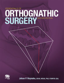 Essentials of Orthognathic Surgery