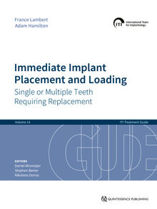 Immediate Implant Placement and Loading  Single or Multiple Teeth Requiring Replacement