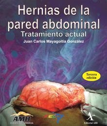 Hernias de la pared abdominal