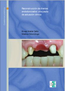 Reconstruccin de dientes endodonciados