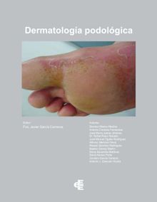 Dermatologa podolgica