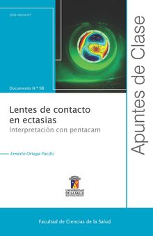 Lentes de contacto en ectasias