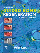 20 YEARS OF GUIDED BONE REGENERATION IN IMPLANT DENTISTRY