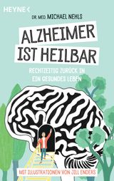 ALZHEIMER IST HEILBAR