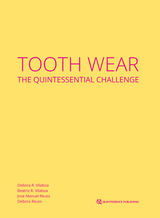 TOOTH WEAR