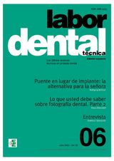 LABOR DENTAL TCNICA N6 VOL.25