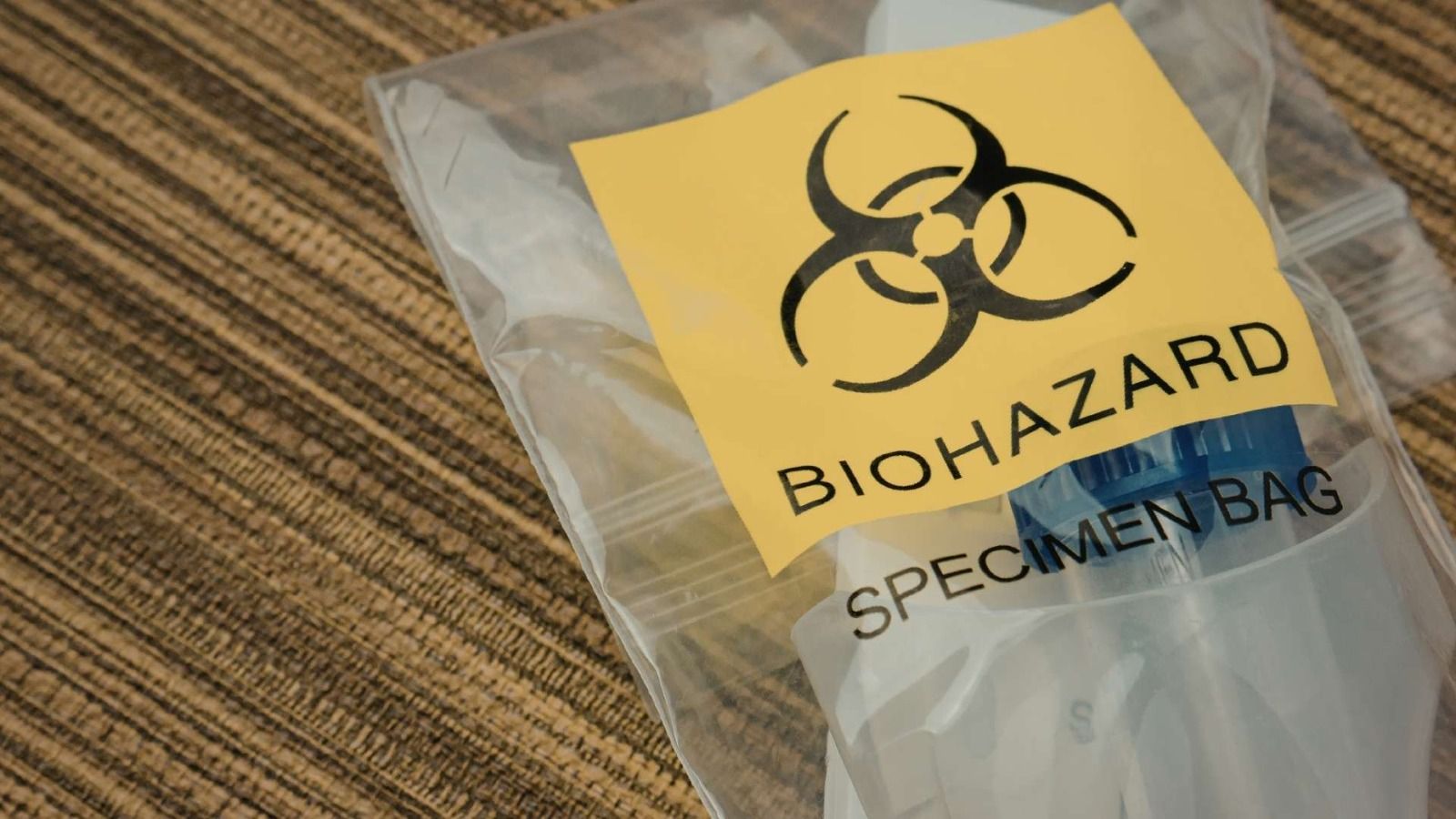 FAQS about Biohazard Cleanup Services in Belleville, NJ