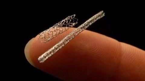 Massive stents scam