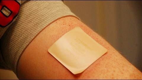 Scientists develop insulin stimulating skin patch for diabetics
