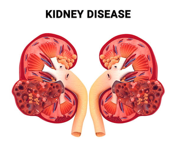 Nephrology