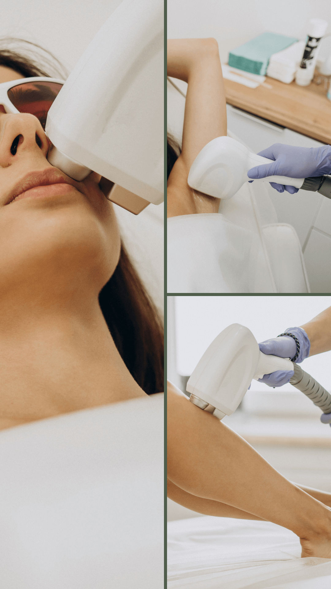 IPL / OPT laser epilation /depilation