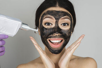 carbon laser peel komárno skin