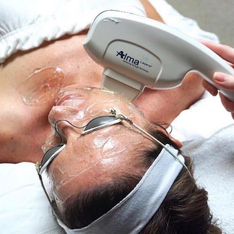 Laser Beauty Madeira Funchal - Image 5
