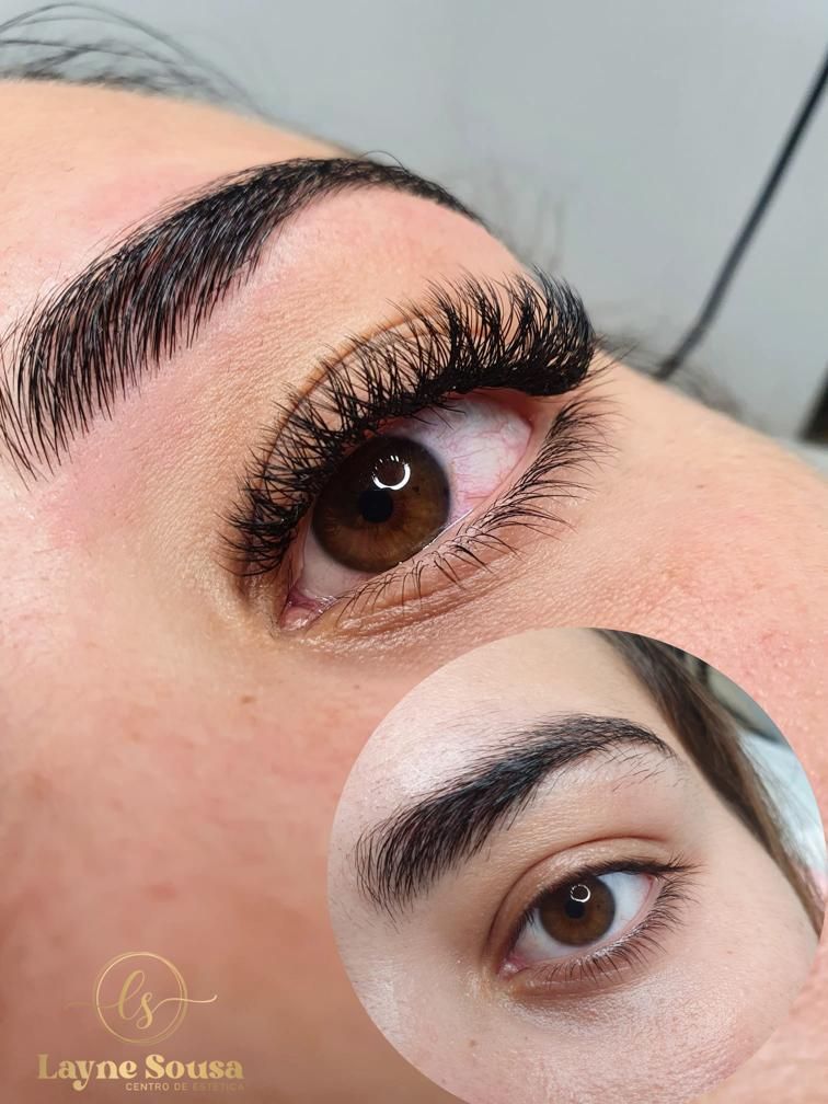 Layne Sousa Centro Estética - Image 6