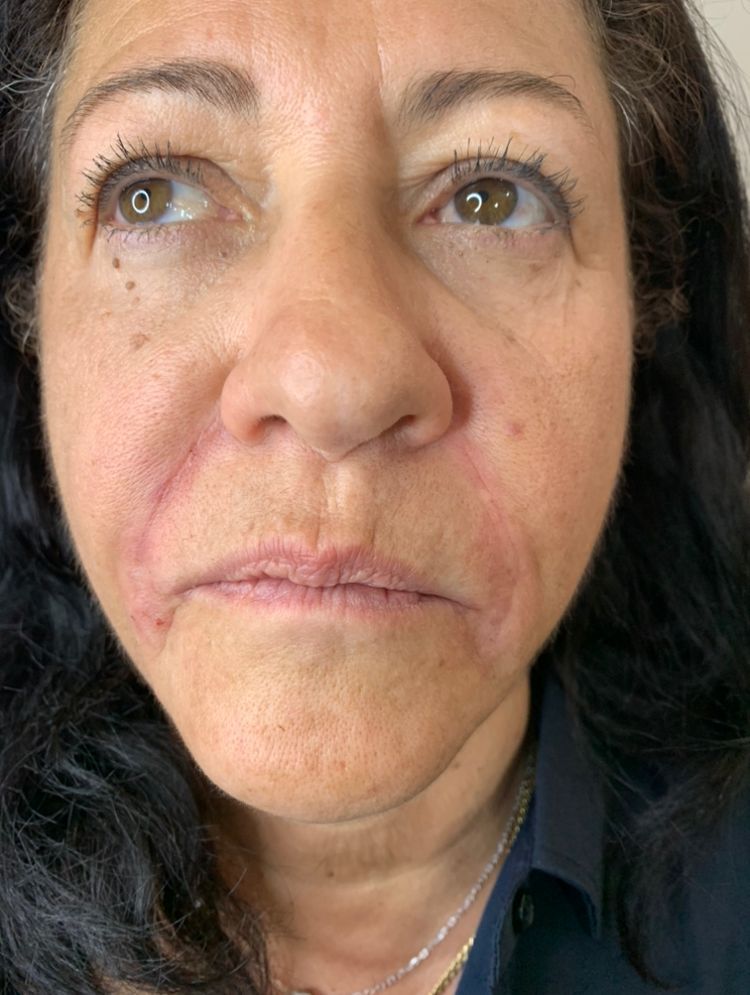 Telma Nicolly Estética Avançada - Image 16
