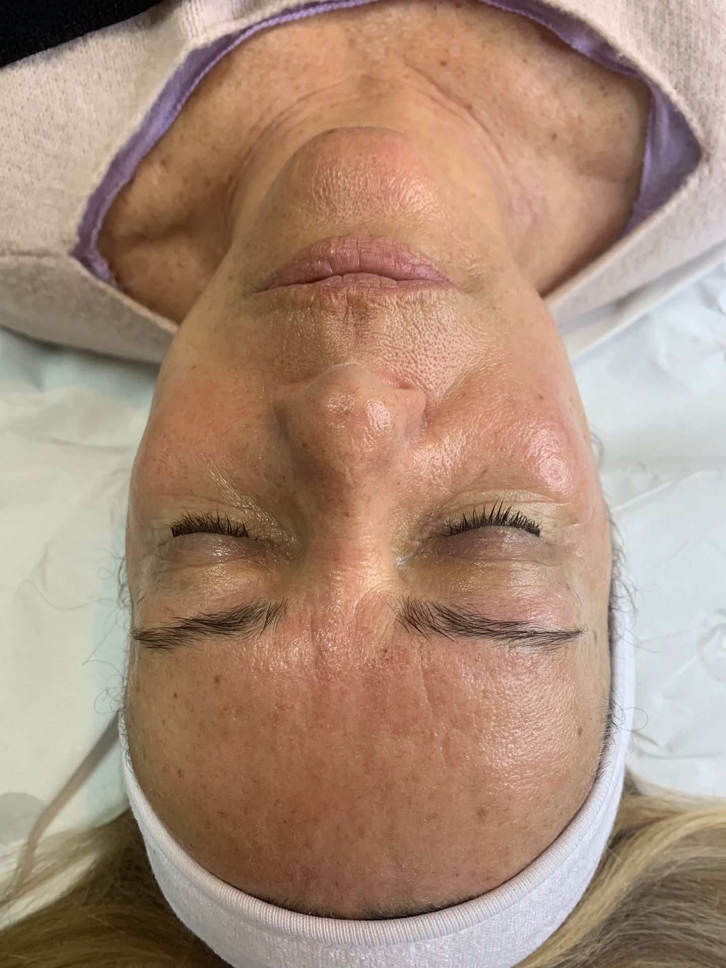 Telma Nicolly Estética Avançada - Image 2