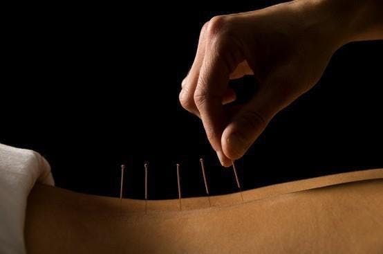 Tiago Maia Acupunctura - Image 2