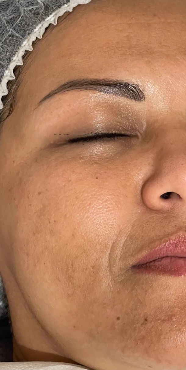 Cristiane Almeida Estética Avançada e Massoterapia - Image 9