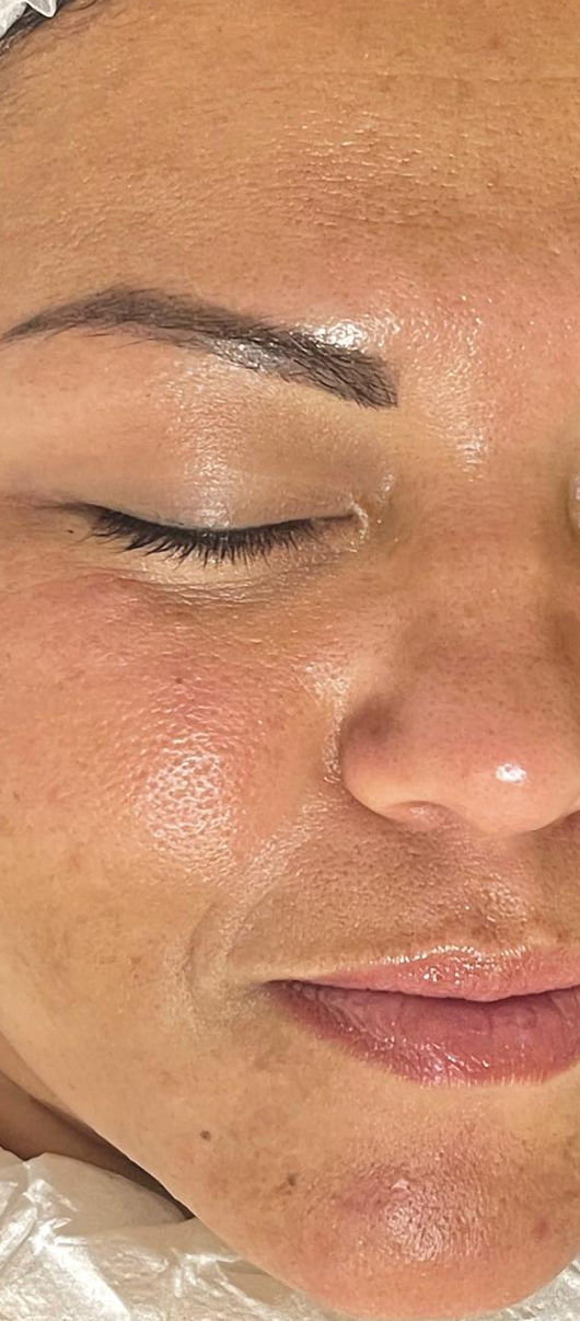 Cristiane Almeida Estética Avançada e Massoterapia - Image 10