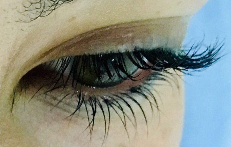 Iny Estética