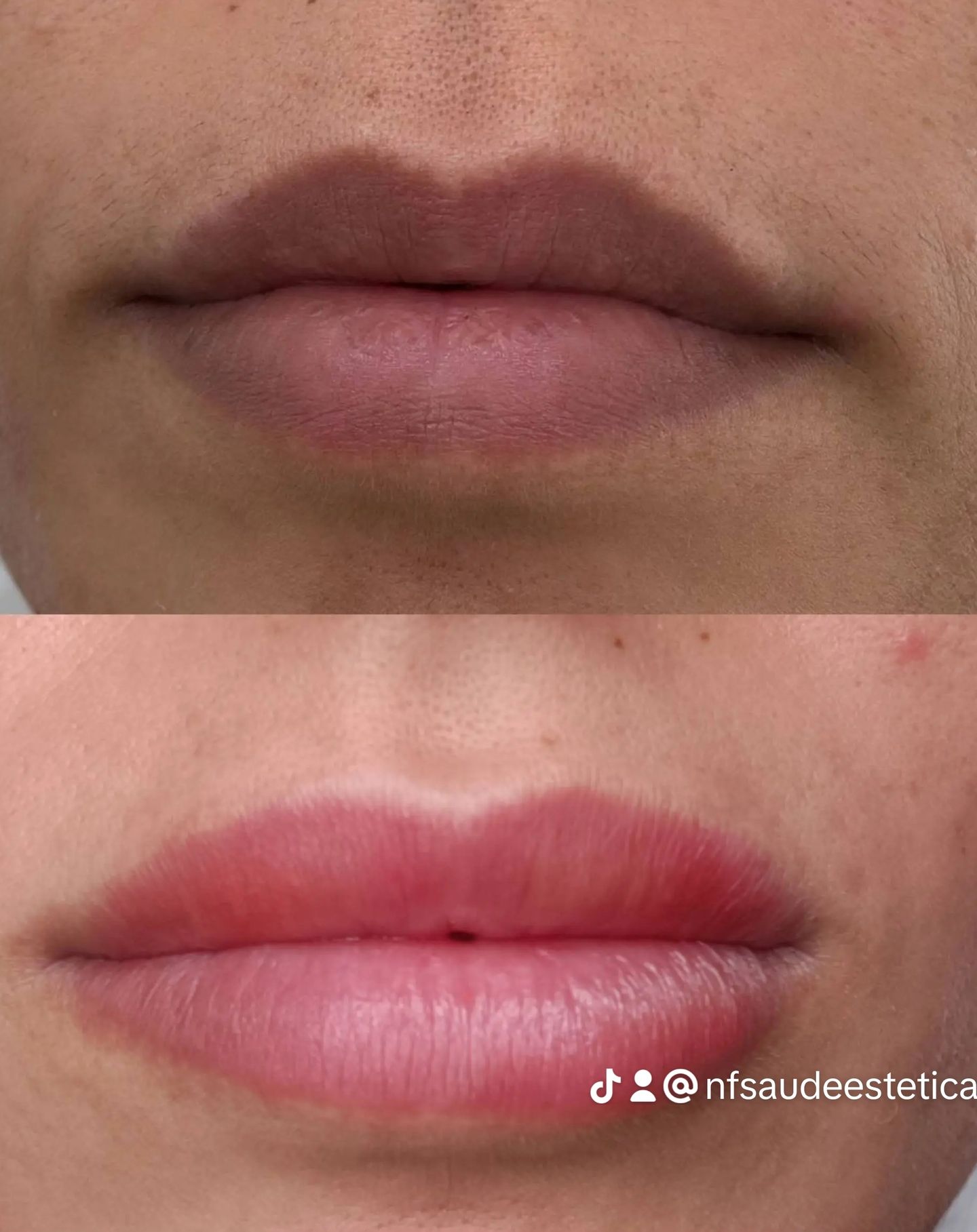 Nádia Ferraz - Saúde & Estética Avançada - Image 11