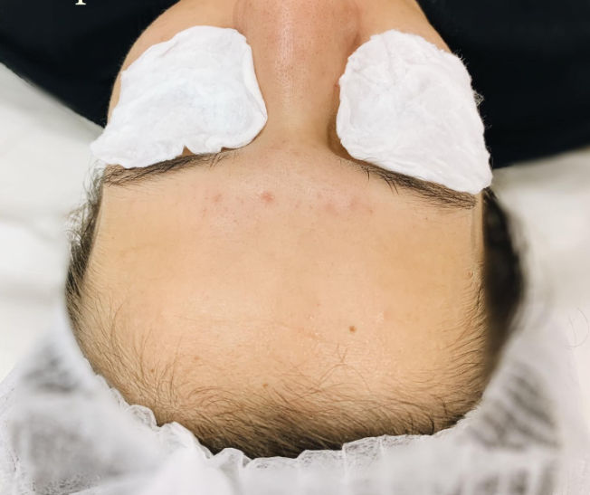 Lainne Estética - Image 7