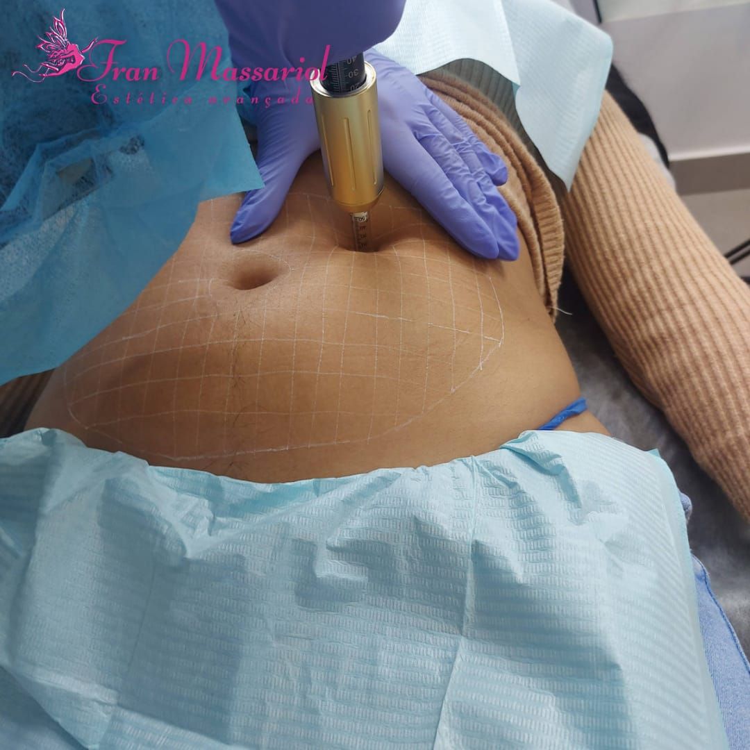 Fran Massariol Estética Avançada - Image 3