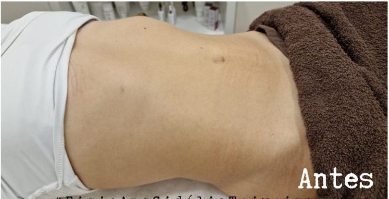 Fisioterapeuta Ana Cidália Teixeira - Image 3