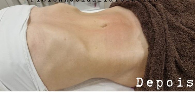 Fisioterapeuta Ana Cidália Teixeira - Image 2