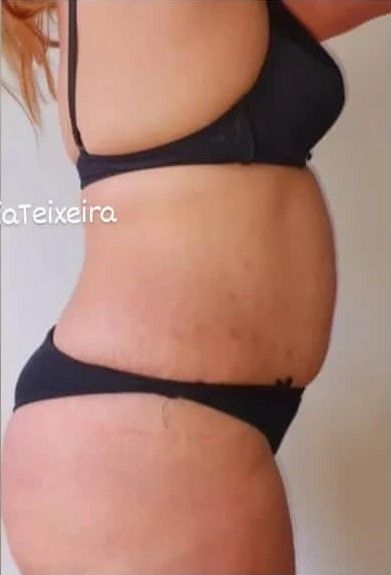 Fisioterapeuta Ana Cidália Teixeira - Image 10
