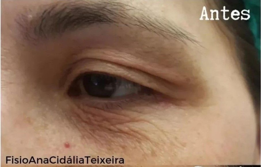 Fisioterapeuta Ana Cidália Teixeira - Image 9