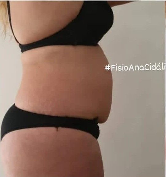 Fisioterapeuta Ana Cidália Teixeira - Image 11