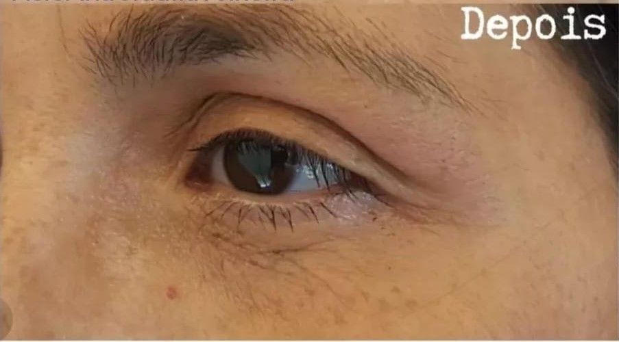 Fisioterapeuta Ana Cidália Teixeira - Image 8