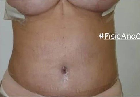 Fisioterapeuta Ana Cidália Teixeira - Image 7