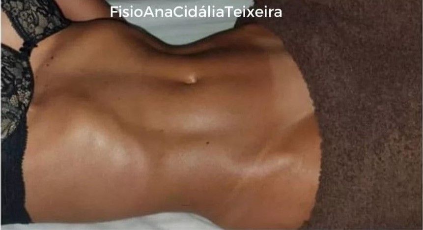 Fisioterapeuta Ana Cidália Teixeira - Image 4