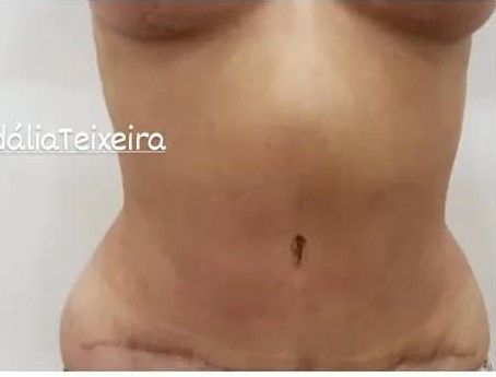 Fisioterapeuta Ana Cidália Teixeira - Image 6