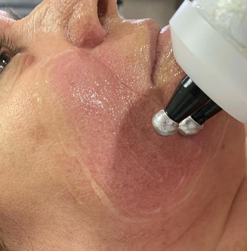 Helenice Mendes - Estética e Saúde - Image 4