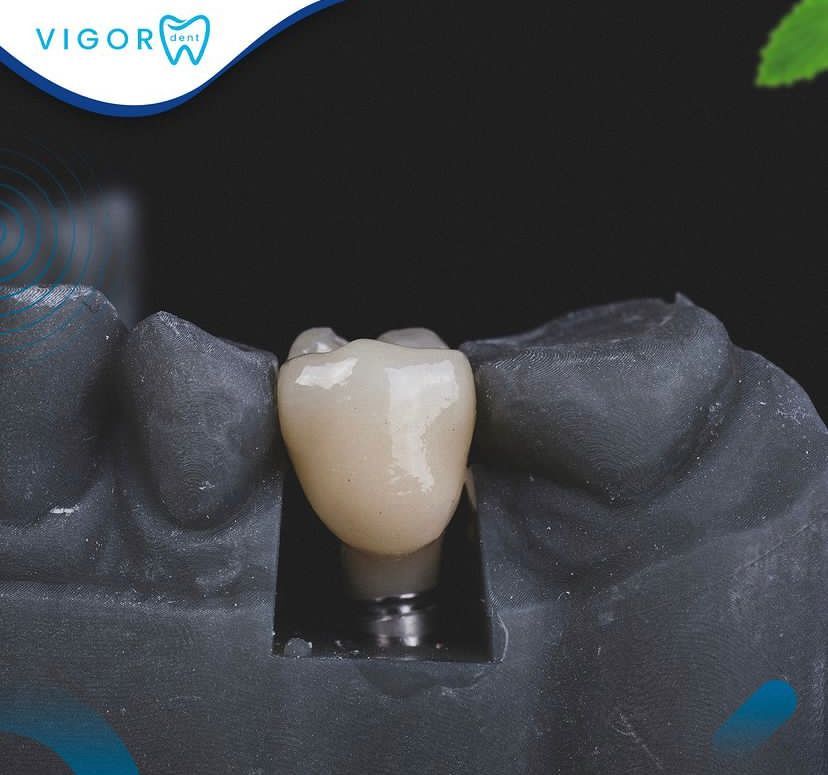 Vigordent - Image 4