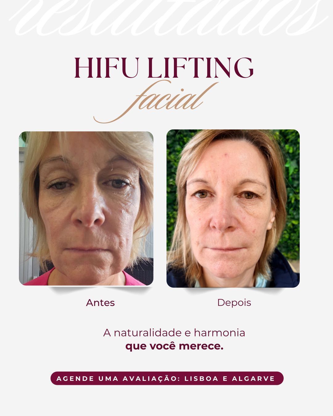 Master Face Karina Figueiredo Estética Avançada - Image 4