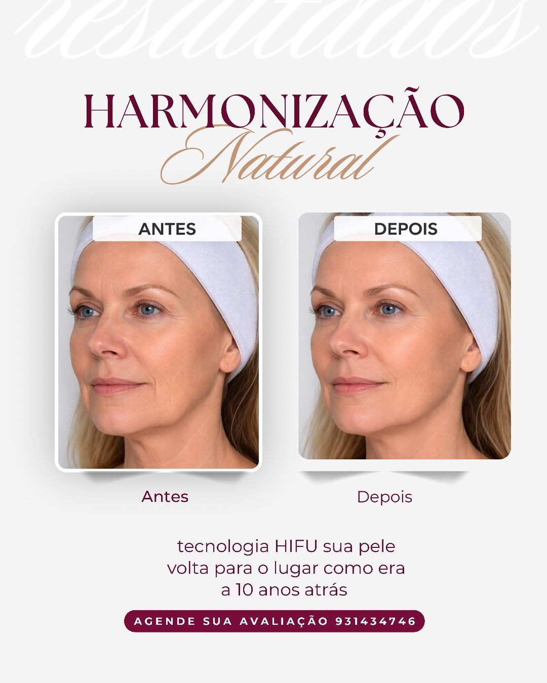 Master Face Karina Figueiredo Estética Avançada - Image 2