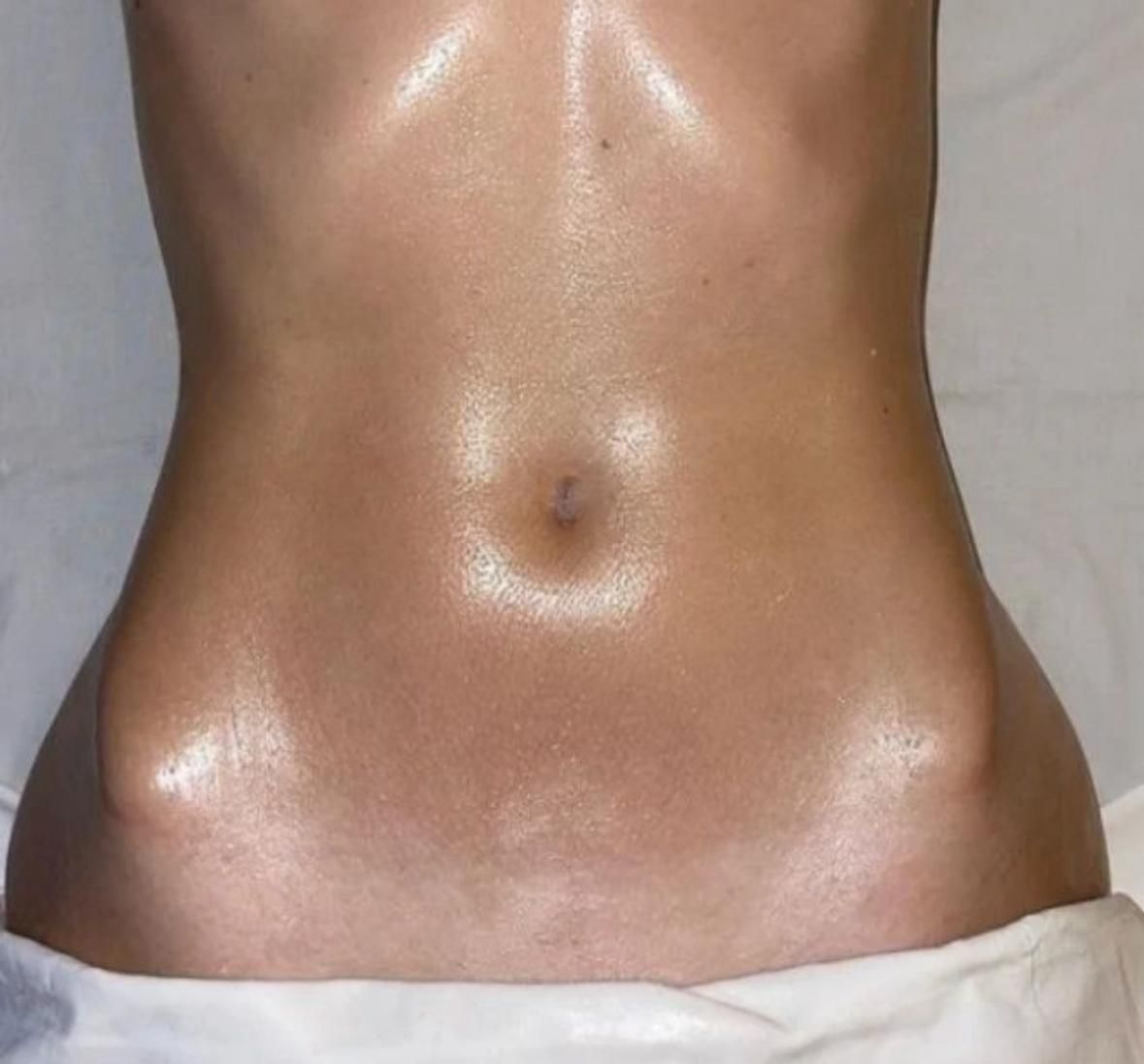 Vilmara Freitas Estética