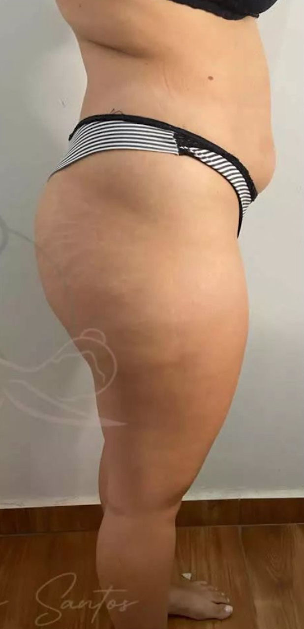 Cátia Santos | Estética e Massoterapia - Image 5