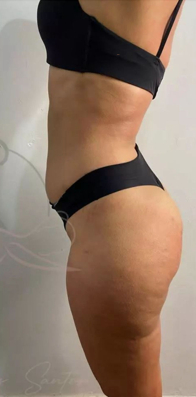 Cátia Santos | Estética e Massoterapia - Image 9