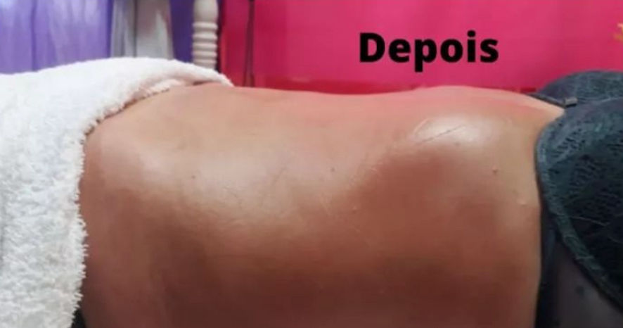 Cátia Santos | Estética e Massoterapia - Image 11